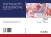 Produktbild: Implant Failures