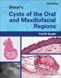 Produktbild: Shear's Cysts of the Oral and Maxillofacial Regions