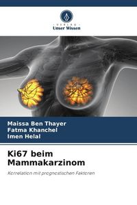 Produktbild: Ki67 beim Mammakarzinom