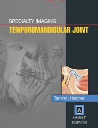 Produktbild: Specialty Imaging: Temporomandibular Joint E-Book
