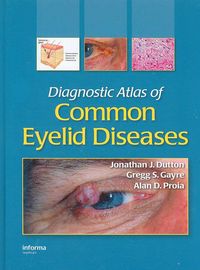 Produktbild: Dutton, J: Diagnostic Atlas of Common Eyelid Diseases