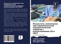 Produktbild: Rezul'taty zazhiwleniq pri periapikal'noj &auml;ndodonticheskoj hirurgii s ispol'zowaniem 2D i CBCT