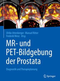 Bild vom Artikel MR- und PET-Bildgebung der Prostata vom Autor 