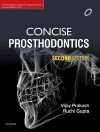 Produktbild: Concise Prosthodontics- E Book
