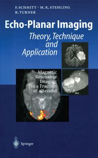 Produktbild: Echo-Planar Imaging
