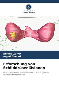Produktbild: Erforschung von Schilddr&uuml;senl&auml;sionen