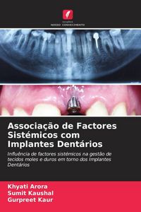 Produktbild: Associa&ccedil;&atilde;o de Factores Sist&eacute;micos com Implantes Dent&aacute;rios