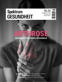 Produktbild: Spektrum Gesundheit 5/2026 - Arthrose