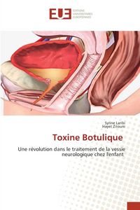 Produktbild: Toxine Botulique