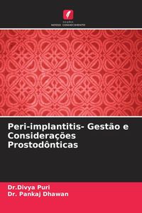 Produktbild: Peri-implantitis- Gest&atilde;o e Considera&ccedil;&otilde;es Prostod&ocirc;nticas