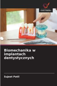 Produktbild: Biomechanika w implantach dentystycznych