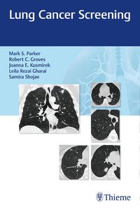 Produktbild: Lung Cancer Screening