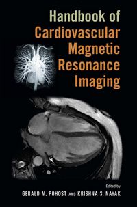 Produktbild: Handbook of Cardiovascular Magnetic Resonance Imaging