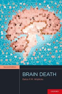 Produktbild: Brain Death 2/e