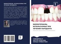 Produktbild: Biomaterialy, Ispol'zuemye Pri Lechenii Parodonta