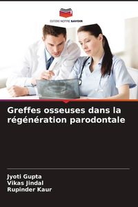 Produktbild: Greffes osseuses dans la r&eacute;g&eacute;n&eacute;ration parodontale