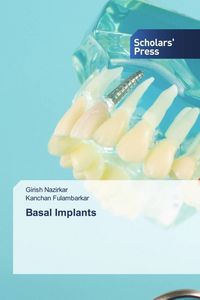 Produktbild: Basal Implants