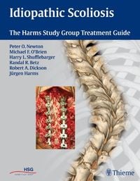 Produktbild: Idiopathic Scoliosis