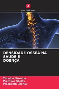 Produktbild: Densidade &Oacute;ssea Na Sa&uacute;de E Doen&ccedil;a