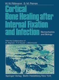 Produktbild: Cortical Bone Healing after Internal Fixation and Infection