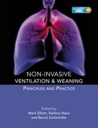 Produktbild: Elliott, M: Non-invasive Ventilation and Weaning: Principles