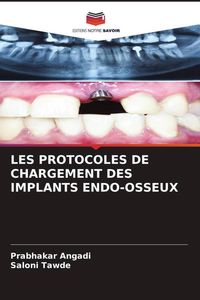 Produktbild: Les Protocoles De Chargement des Implants Endo-Osseux