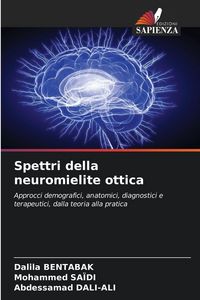 Produktbild: Spettri della neuromielite ottica