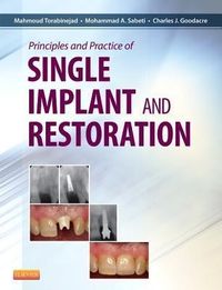 Produktbild: Principles and Practice of Single Implant and Restoration