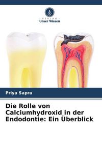 Produktbild: Die Rolle von Calciumhydroxid in der Endodontie: Ein &Uuml;berblick