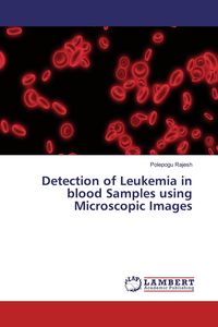 Produktbild: Detection of Leukemia in blood Samples using Microscopic Images