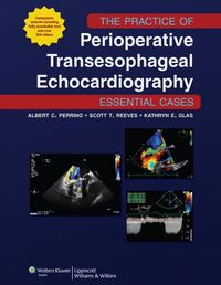 Produktbild: The Practice of Perioperative Transesophageal Echocardiography