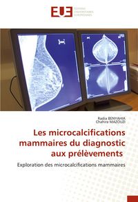 Produktbild: Les microcalcifications mammaires du diagnostic aux pr&eacute;l&egrave;vements