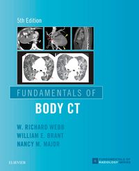 Produktbild: Fundamentals of Body CT E-Book
