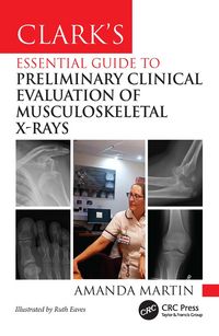 Produktbild: Clark's Essential Guide to Preliminary Clinical Evaluation of Musculoskeletal X-rays