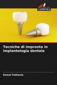 Produktbild: Tecniche di impronta in implantologia dentale