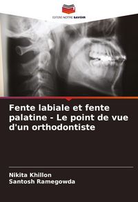 Produktbild: Fente labiale et fente palatine - Le point de vue d'un orthodontiste