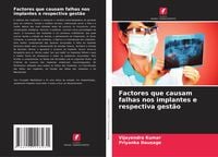 Produktbild: Factores que causam falhas nos implantes e respectiva gest&atilde;o
