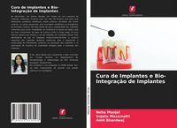 Produktbild: Cura de Implantes e Bio- Integra&ccedil;&atilde;o de Implantes