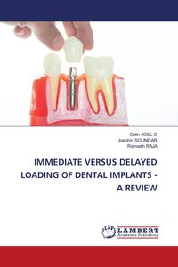 Produktbild: Immediate Versus Delayed Loading Of Dental Implants - a Review