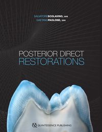 Posterior Direct Restorations