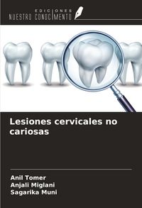 Produktbild: Lesiones cervicales no cariosas