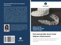 Produktbild: Extrusionskr&auml;fte durch Clear Aligners Attachments