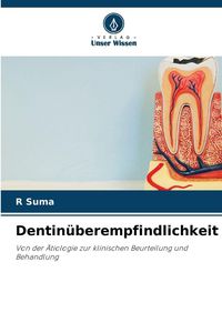 Produktbild: Dentin&uuml;berempfindlichkeit