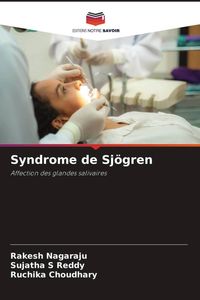 Produktbild: Syndrome de Sj&ouml;gren