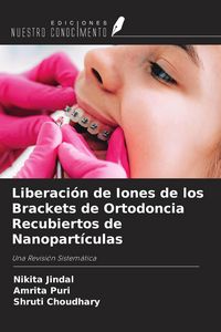 Produktbild: Liberaci&oacute;n de Iones de los Brackets de Ortodoncia Recubiertos de Nanopart&iacute;culas