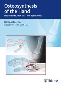 Produktbild: Osteosynthesis of the Hand