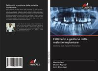 Produktbild: Fallimenti e gestione delle malattie implantare