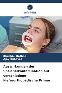 Produktbild: Auswirkungen der Speichelkontamination auf verschiedene kieferorthop&auml;dische Primer