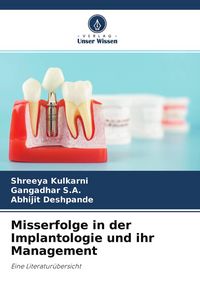 Produktbild: Misserfolge in der Implantologie und ihr Management