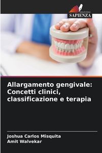 Produktbild: Allargamento gengivale: Concetti clinici, classificazione e terapia